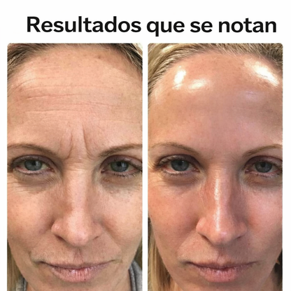 Retinal Shot by VELORA ★ Para una piel más joven y brillante