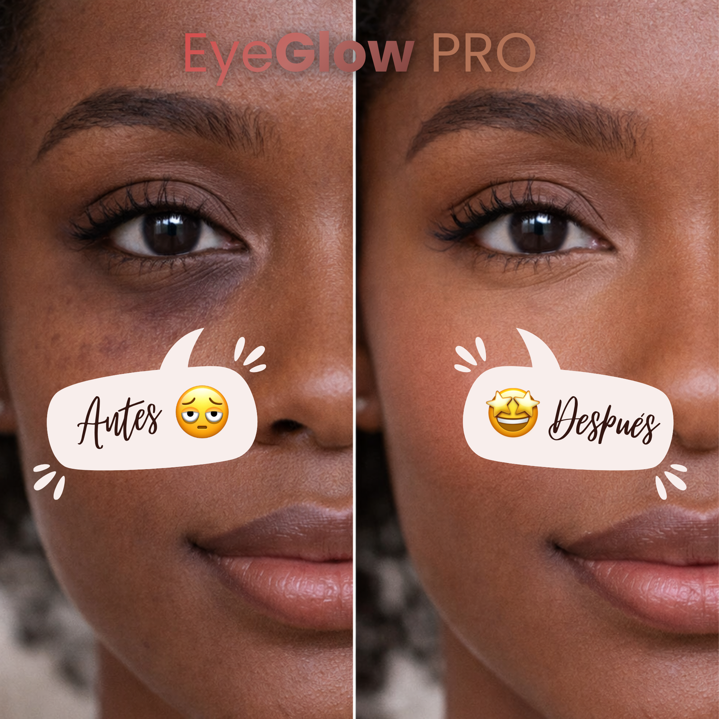 EyeGlow PRO by VELORA ★ Oculta tus ojeras y revive tu mirada