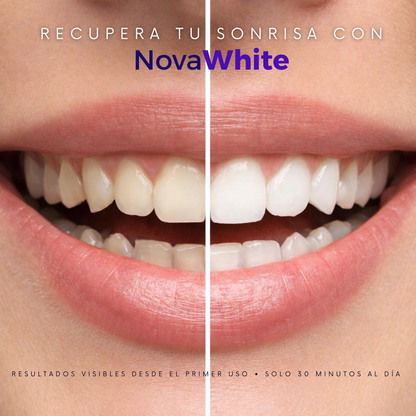 NovaWhite Strips by VELORA ★ Tus dientes más brillantes que nunca